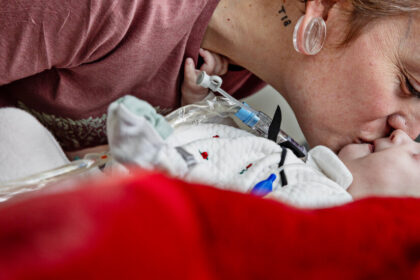 How 2 Families Faced a Catastrophic Birth Defect